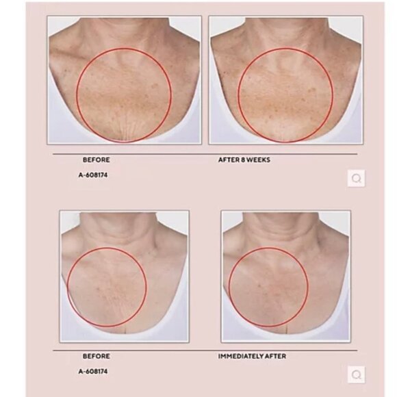 Crepe Erase Body Smoothing & Foot Mask and Peel set 285 mL/ 10 FL OZ - Picture 2 of 7